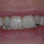 Case CC Before 1