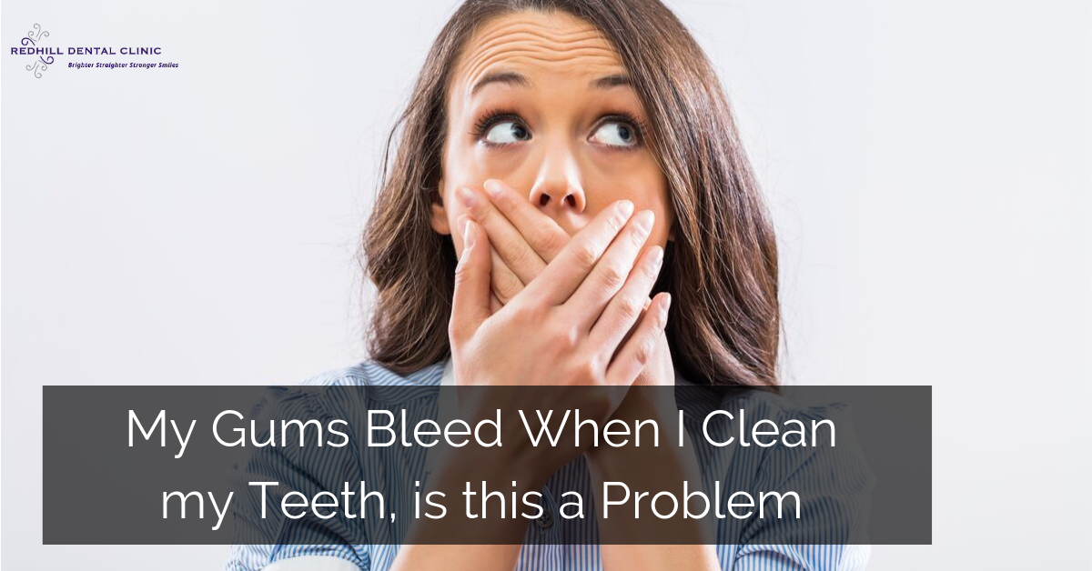 Gums bleed when teeth cleaned