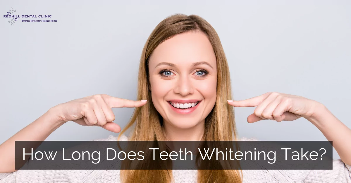 how long does teeth whitening take